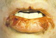 Acne-dry lips-side effect of isotretinoin