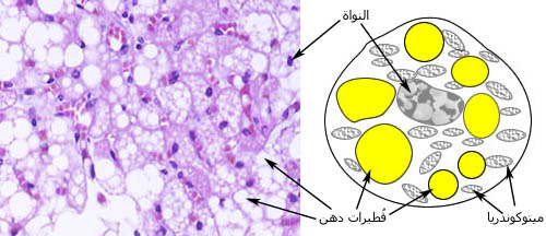 brown_adipose_adipocyte.jpg
